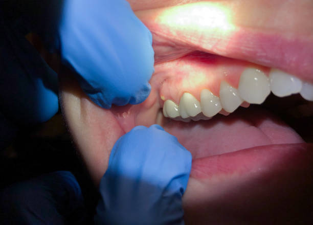 Best Emergency Dental Services for Seniors in Port Norris, NJ